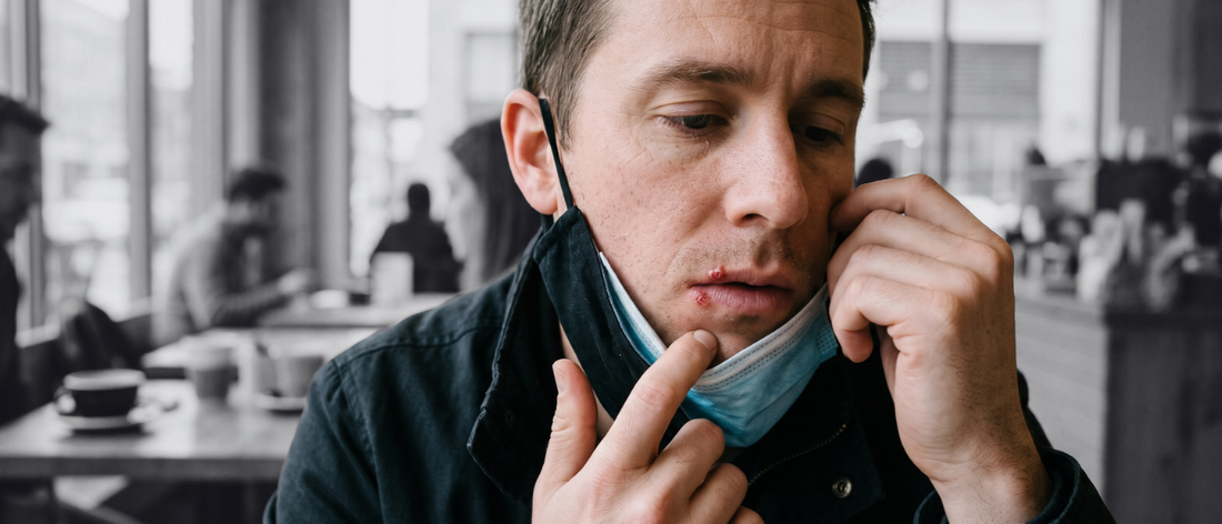 Person touching a cold sore on the lower lip.